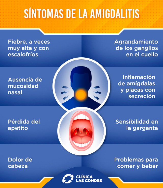 amigdalitis: síntomas