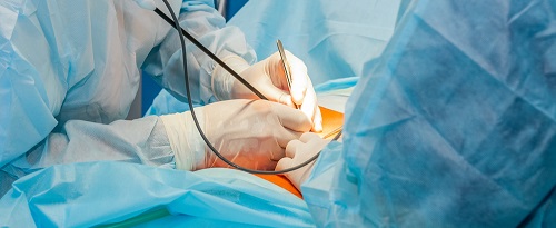 Equipo de doctores realizan una cirugía