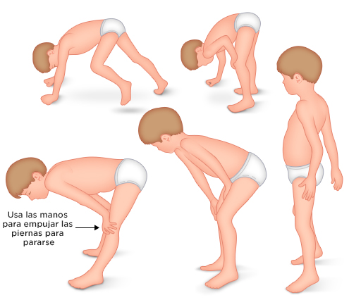 signo de gowers