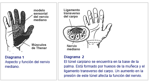 Represalias solamente Dureza Síndrome del túnel carpiano - Clínica Las Condes