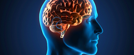 Detectar un ataque cerebral temprano es vital para evitar grandes daños al cerebro