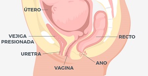 Piso pélvico: disfunciones, síntomas y tratamientos - Clínica Las Condes