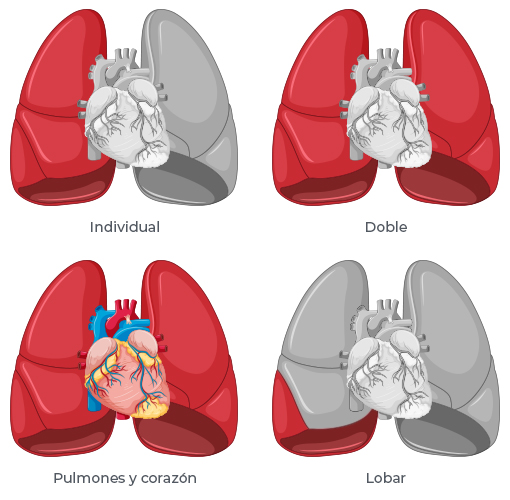 tipos de trasplante de pulmón