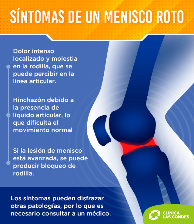 Síntomas de rotura de meniscos