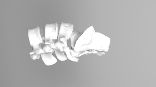 Lumbar 3d