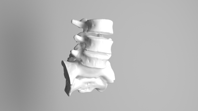 Lumbar 3d