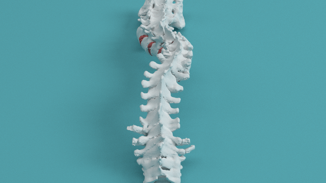 Lumbar 3d