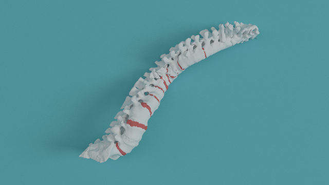 Lumbar 3d