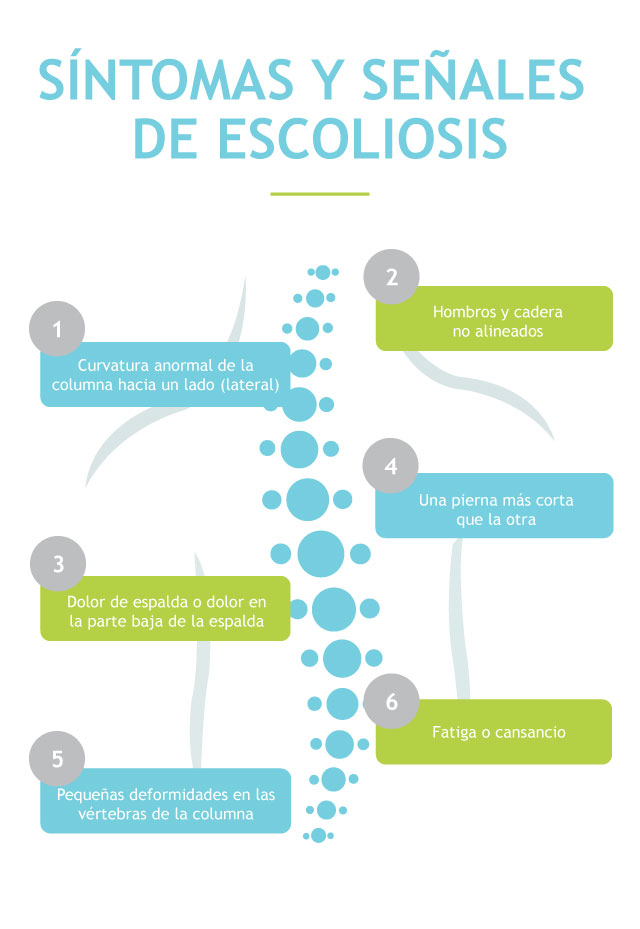 Escoliosis o desviación lateral de columna - Qué es, causas, tipos 