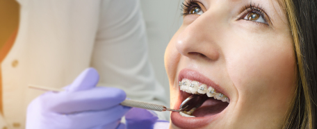 Mujer en tratamiento de ortodoncia