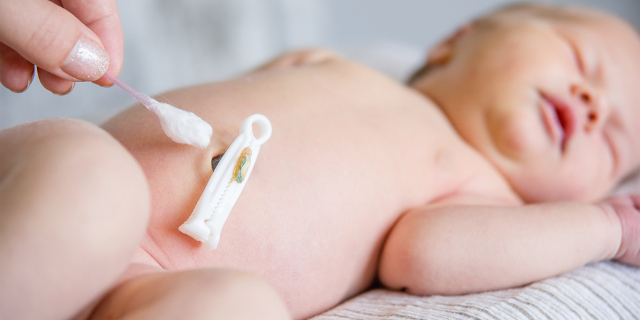 Cuidados e higiene del ombligo del bebé recién nacido