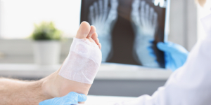 Un doctor mira una radiografía de la pierna herida de un hombre