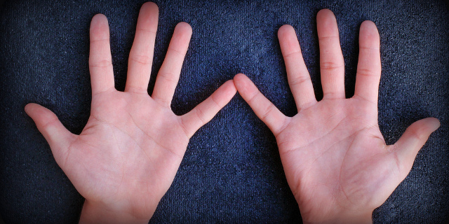 Dolor y deformidad en los dedos: atentos a la artrosis de manos Clínica Las Condes