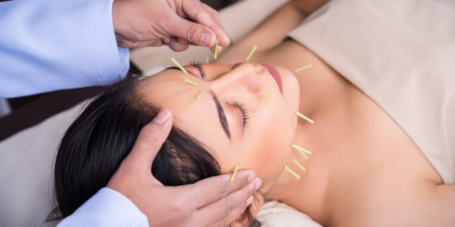 Los usos de la acupuntura