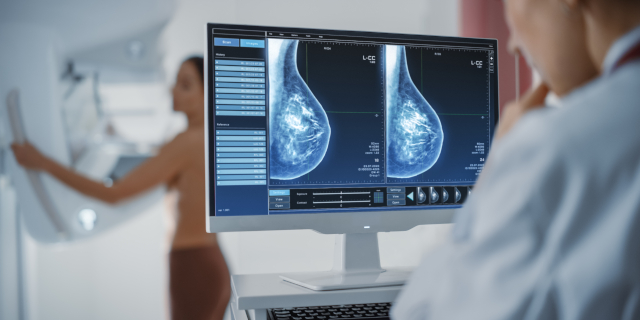 mujer haciéndose mamografía