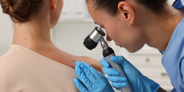 CÁNCER DE PIEL: CÓMO DETECTARLO A TIEMPO Y PREVENIRLO