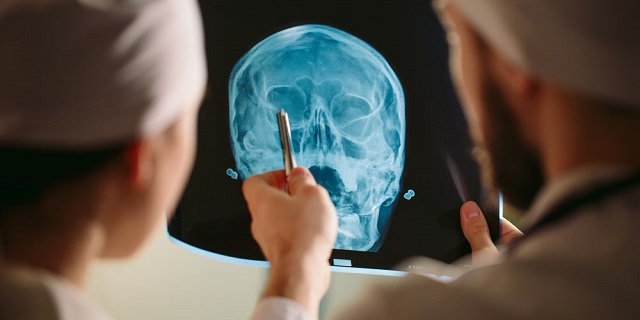 Doctores analizando radiografía de cráneo